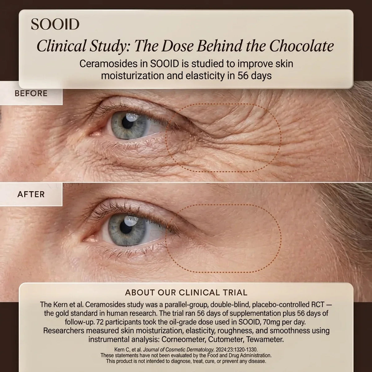 Crow’s feet before and after eight weeks of Ceramosides™, measured